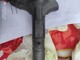 Toyota Rav4 Kaksi suutinta 2.0 D4d 116hv